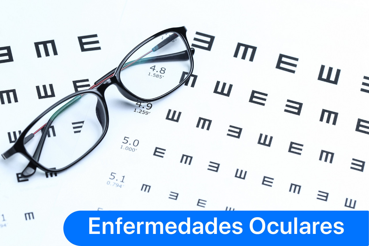 Enfermedades Oculares